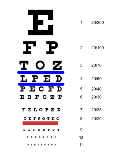 SnellenEyeChart